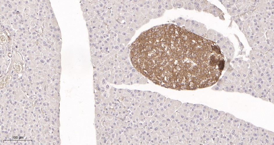 Recombinant DRP1 Monoclonal Antibody - small - 2