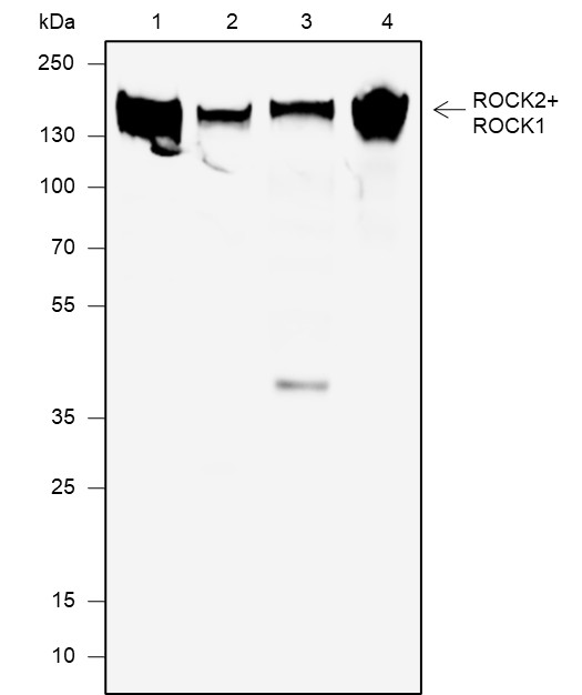 Recombinant ROCK2+ROCK1 Monoclonal Antibody-searchlist-1