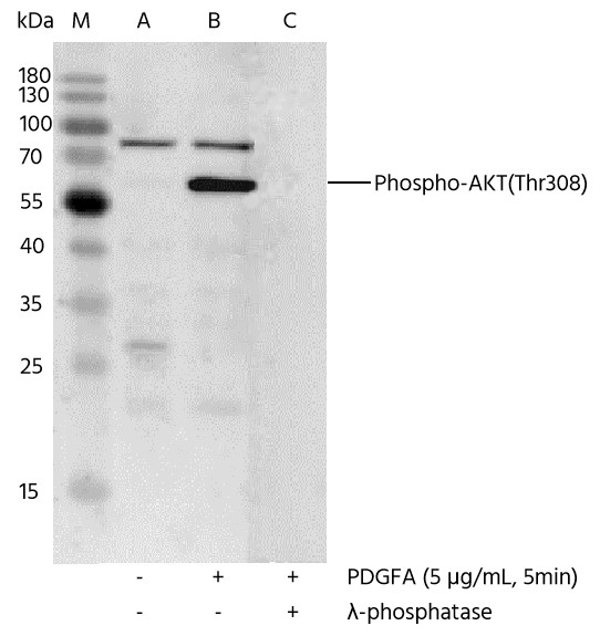 Recombinant Phospho-Akt (Thr308) Monoclonal Antibody - small - 2
