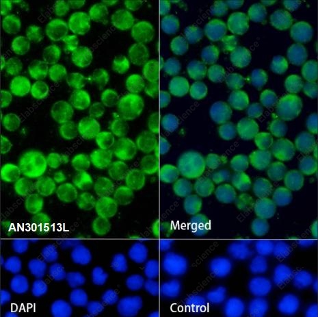 Recombinant eIF3B Monoclonal Antibody - 3
