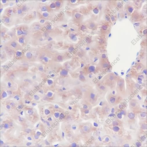 Recombinant GOT2 Monoclonal Antibody - 3