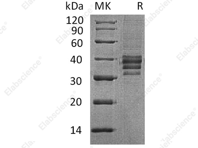 Recombinant Human Follistatin 288/FST Protein - 1