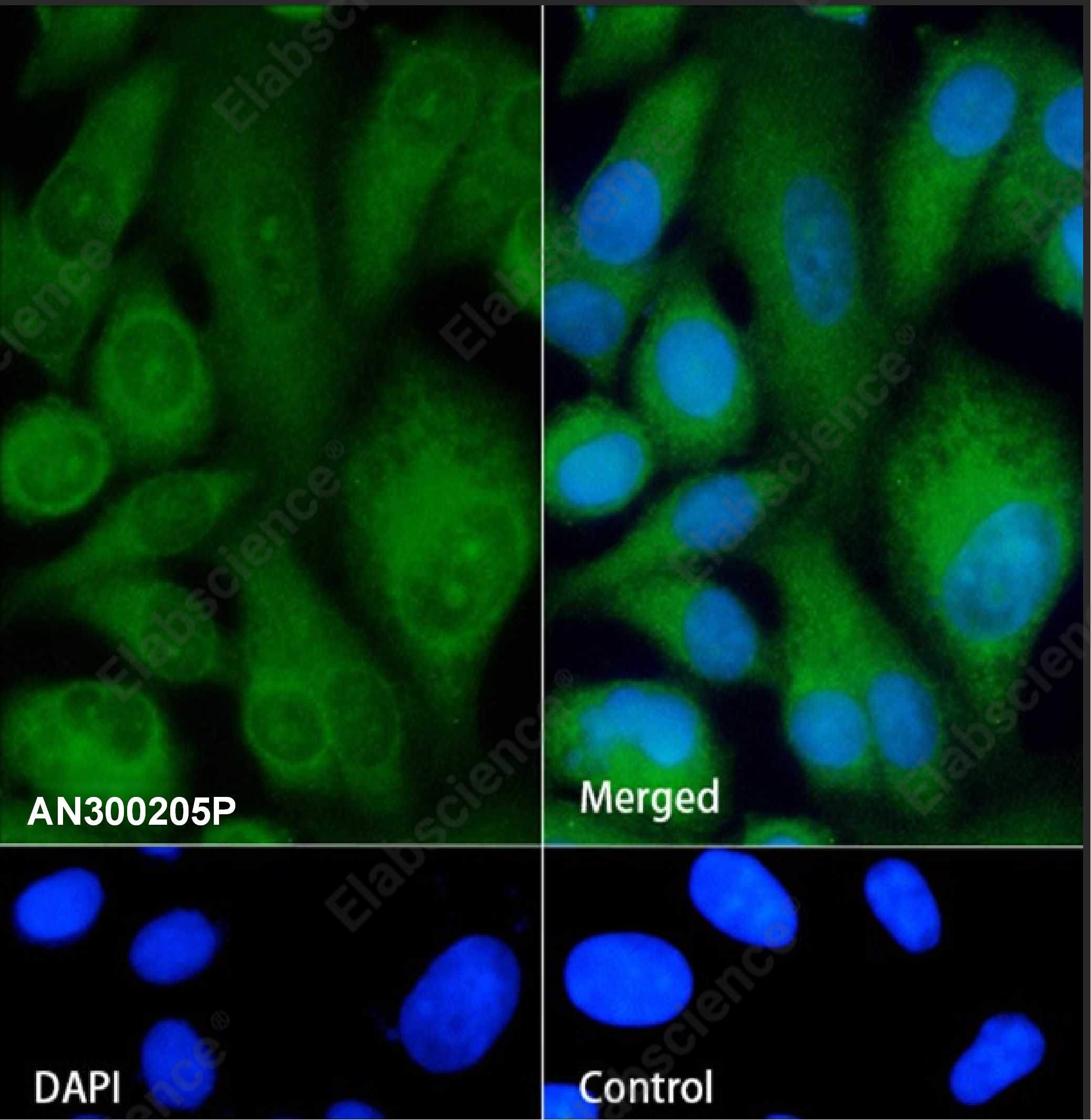 Recombinant ASGPR1 Monoclonal Antibody - 1