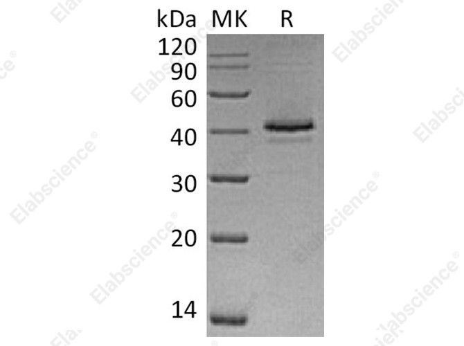 Recombinant Human CAMK1/CaMKI-alpha Protein (His Tag) - 1