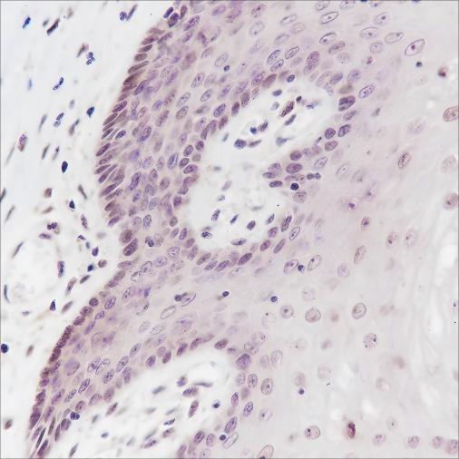 Recombinant Cyclin D3 Monoclonal Antibody - 2