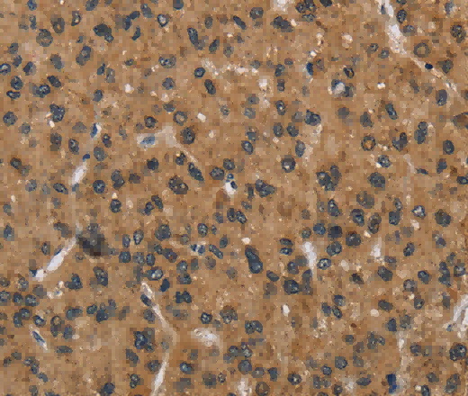 HSP40-4 Polyclonal Antibody - 3