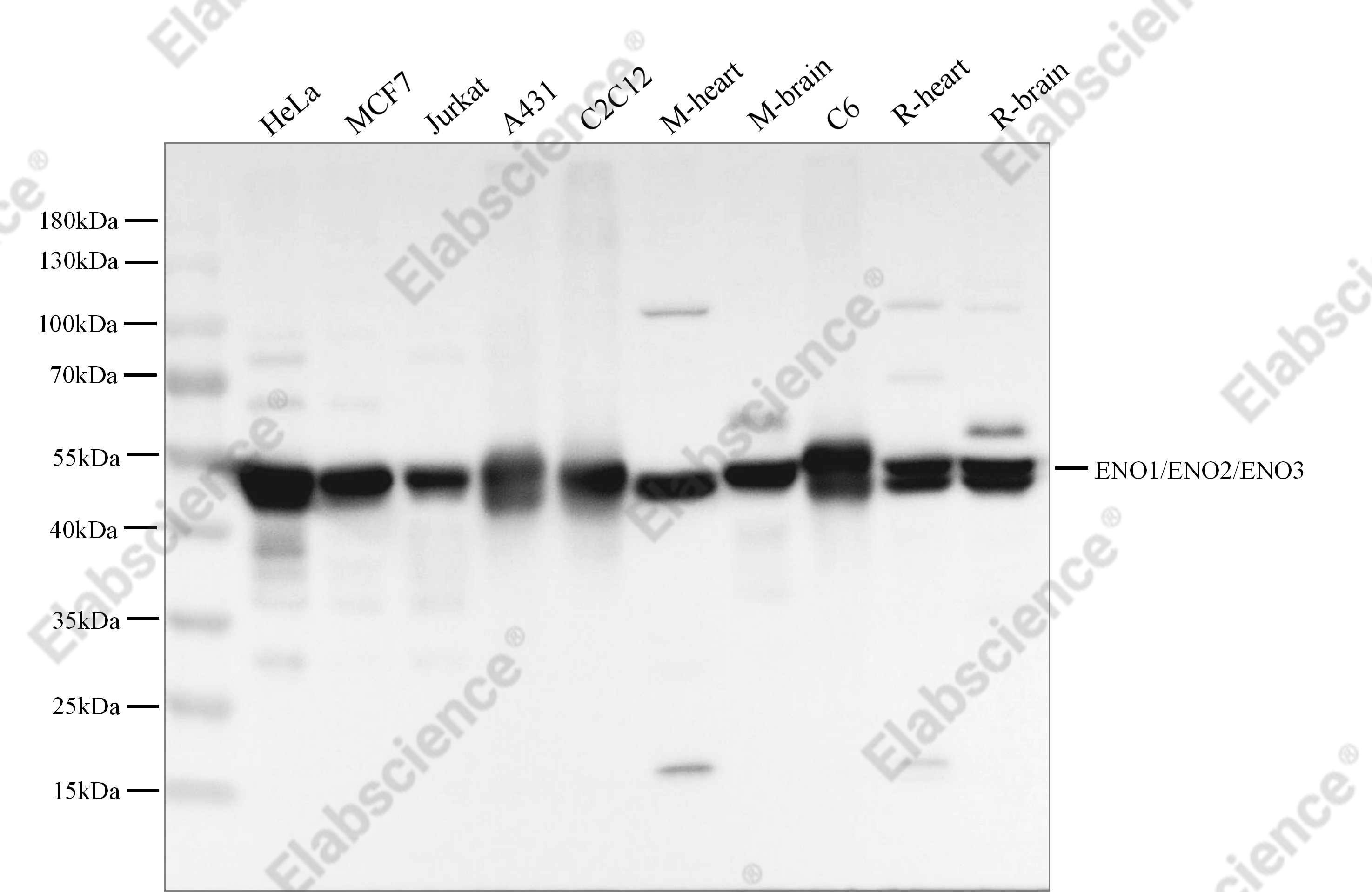 Recombinant ENO3/beta-enolase Monoclonal Antibody - 1