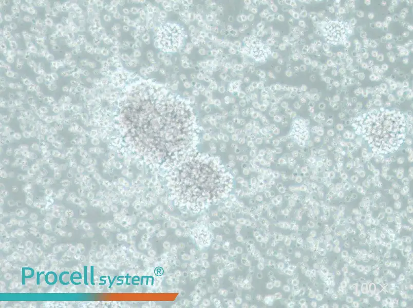 SU-DHL-10 Cell Complete Medium - 1