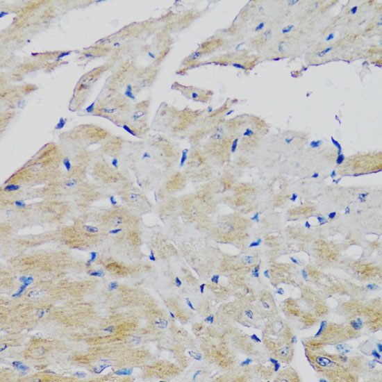 FGFR2 Polyclonal Antibody - small - 6