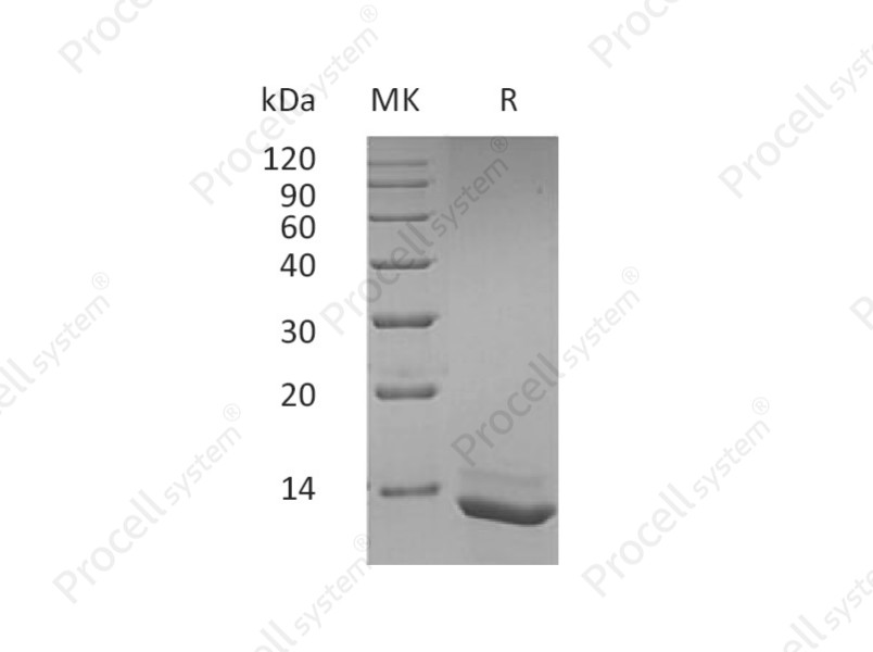 IL-15/IL-T, Human, Recombinant