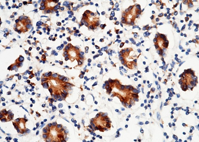 P4HB/ERBA2L Monoclonal Antibody-searchlist-1