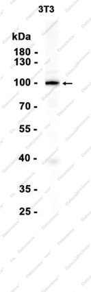 Recombinant Ubiquitin Protein Ligase E3A Monoclonal Antibody - 1