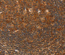 HDAC8 Polyclonal Antibody - 2