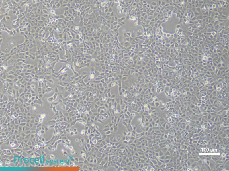 Rat Cardiac Fibroblasts (Primary cell immortalization)Rat Cardiac Fibroblasts (Primary cell immortalization) - 2