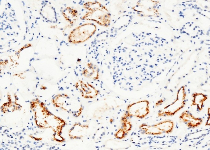 RBP4 Monoclonal Antibody - small - 3
