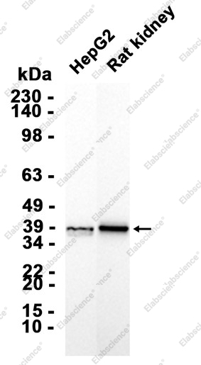 Recombinant Arg2 Monoclonal Antibody - 2