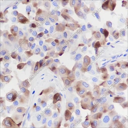 Recombinant GCDFP-15 Monoclonal Antibody - 2
