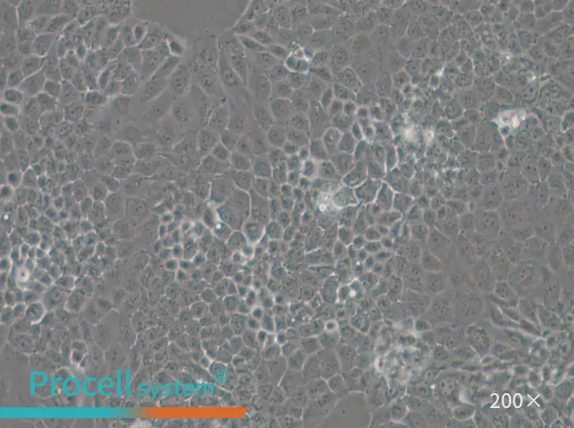 MKN74 Cell Complete Medium - 6