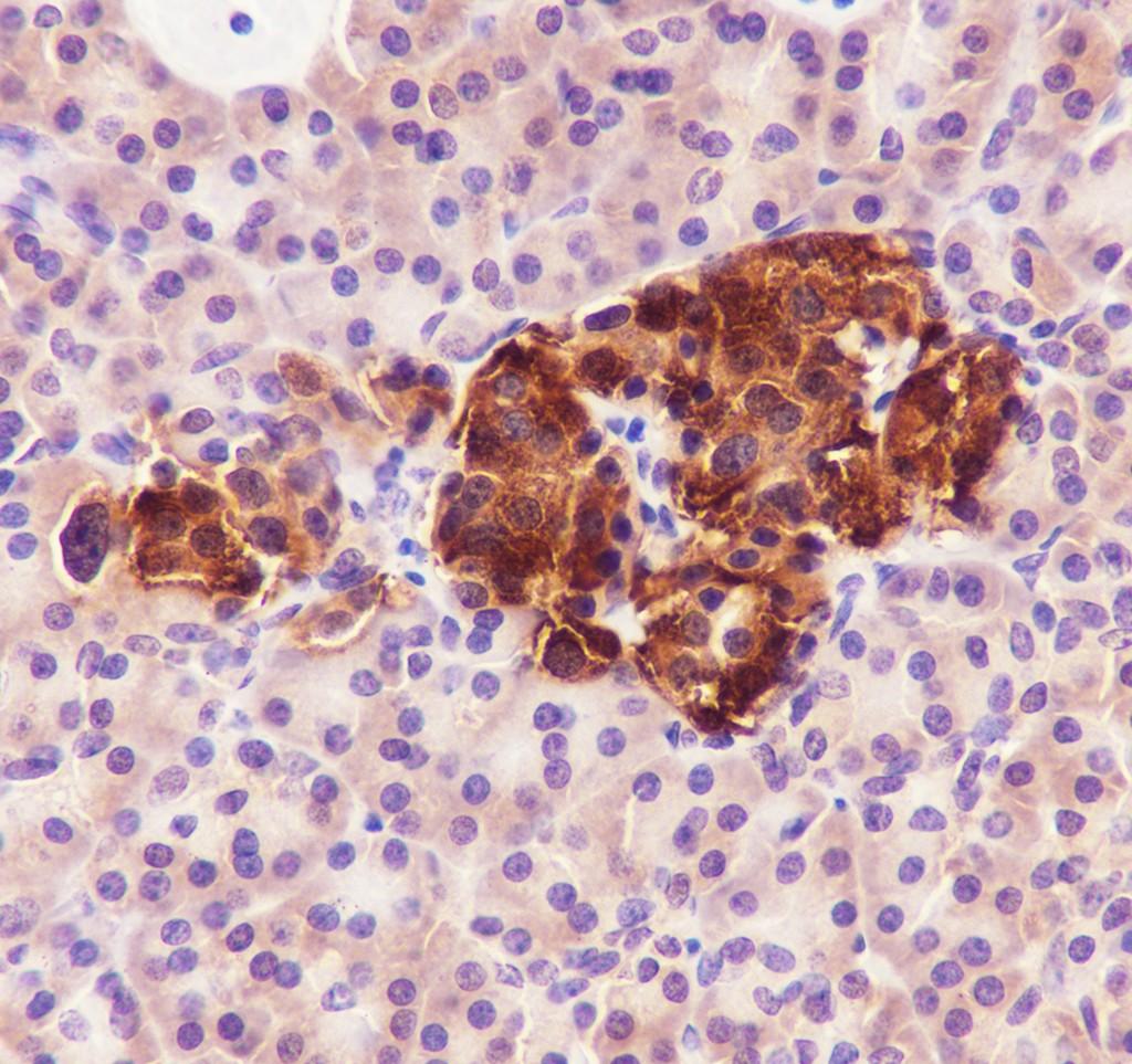 Recombinant ATP Citrate Lyase Monoclonal Antibody-searchlist-2