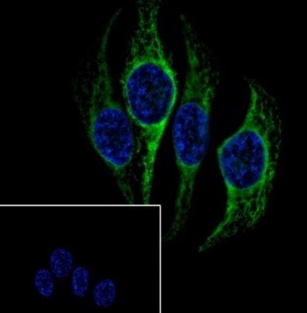 Recombinant Heme Oxygenase 1 Monoclonal Antibody - small - 6