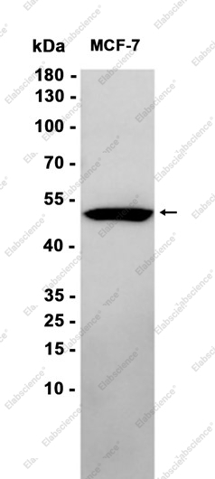 Recombinant HAPLN1 Monoclonal Antibody - 2