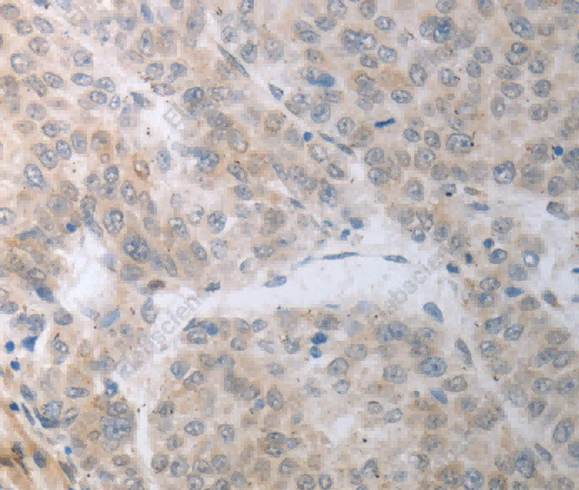 RBMS3 Polyclonal Antibody - 3