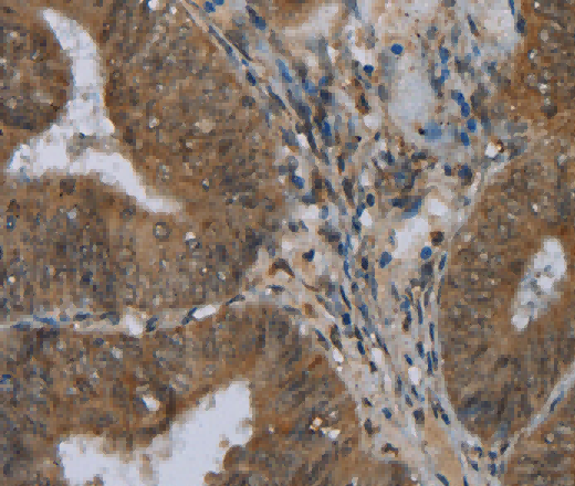 NAT10 Polyclonal Antibody - 2
