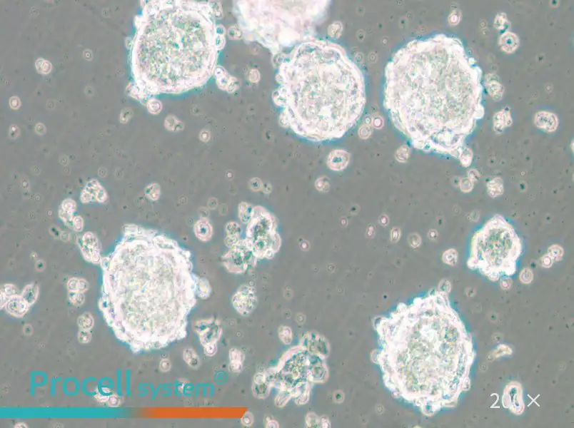 SK-ES-1 Cell Complete Medium - 6