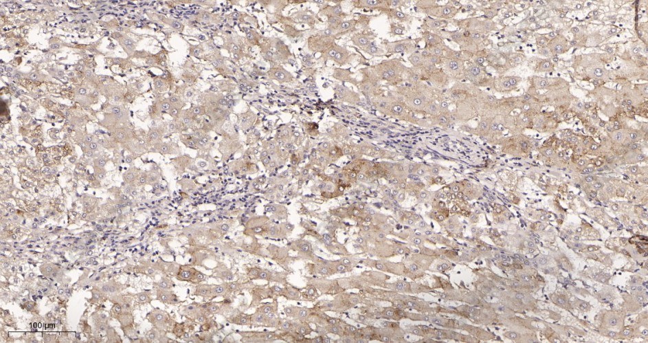 Recombinant LRP1 Monoclonal Antibody - 2