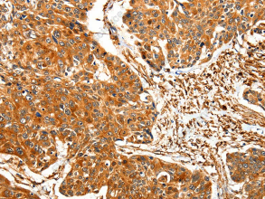 TPM2 Polyclonal Antibody - 2