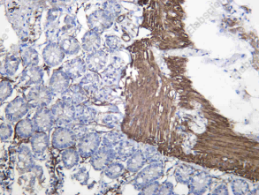 Recombinant Myosin Heavy Chain, Smooth Muscle (SMMHC) Monoclonal Antibody - 3