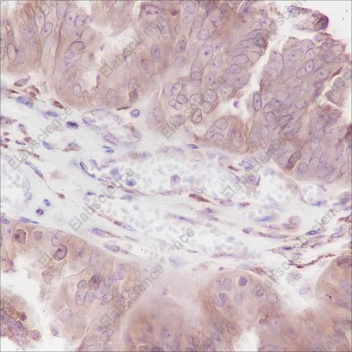 Recombinant Thymidylate Synthase Monoclonal Antibody - 3