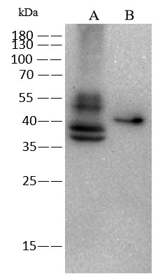 TROP2/TACSTD2 Monoclonal Antibody - small - 5