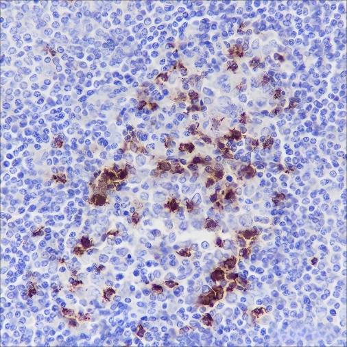Recombinant PD1 Monoclonal Antibody-searchlist-1
