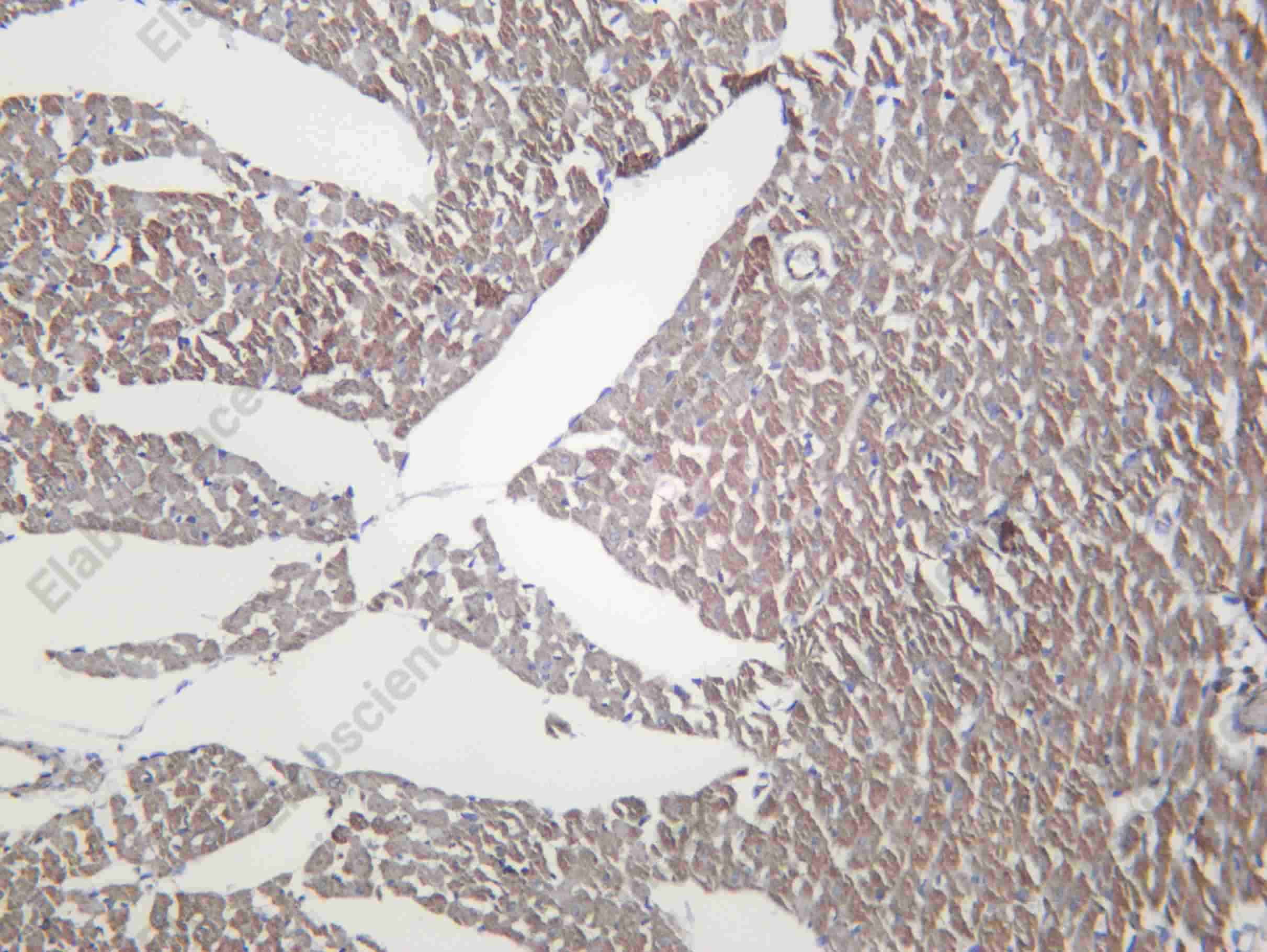 Recombinant OGDH Monoclonal Antibody - 3