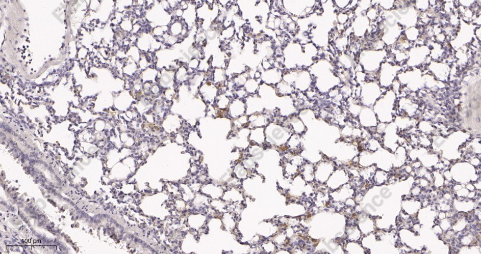 Recombinant Cytokeratin 5 Monoclonal Antibody - 3