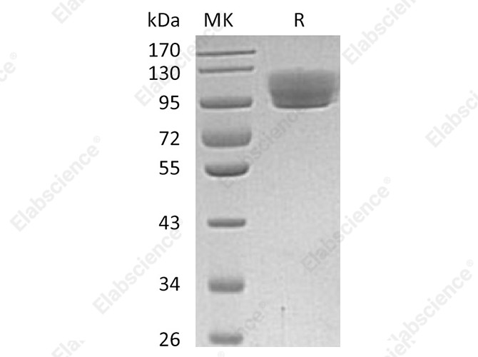 Recombinant Human ROBO4 Protein (Fc Tag) - 1
