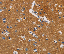 GPM6A Polyclonal Antibody - 2