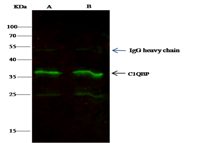 C1QBP/HABP1 Monoclonal Antibody