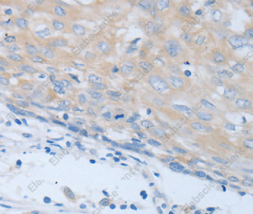 CHRNA7 Polyclonal Antibody - 3