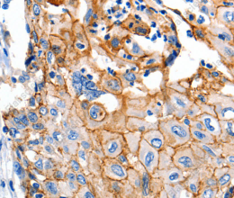 Claudin 1 Polyclonal Antibody - 3