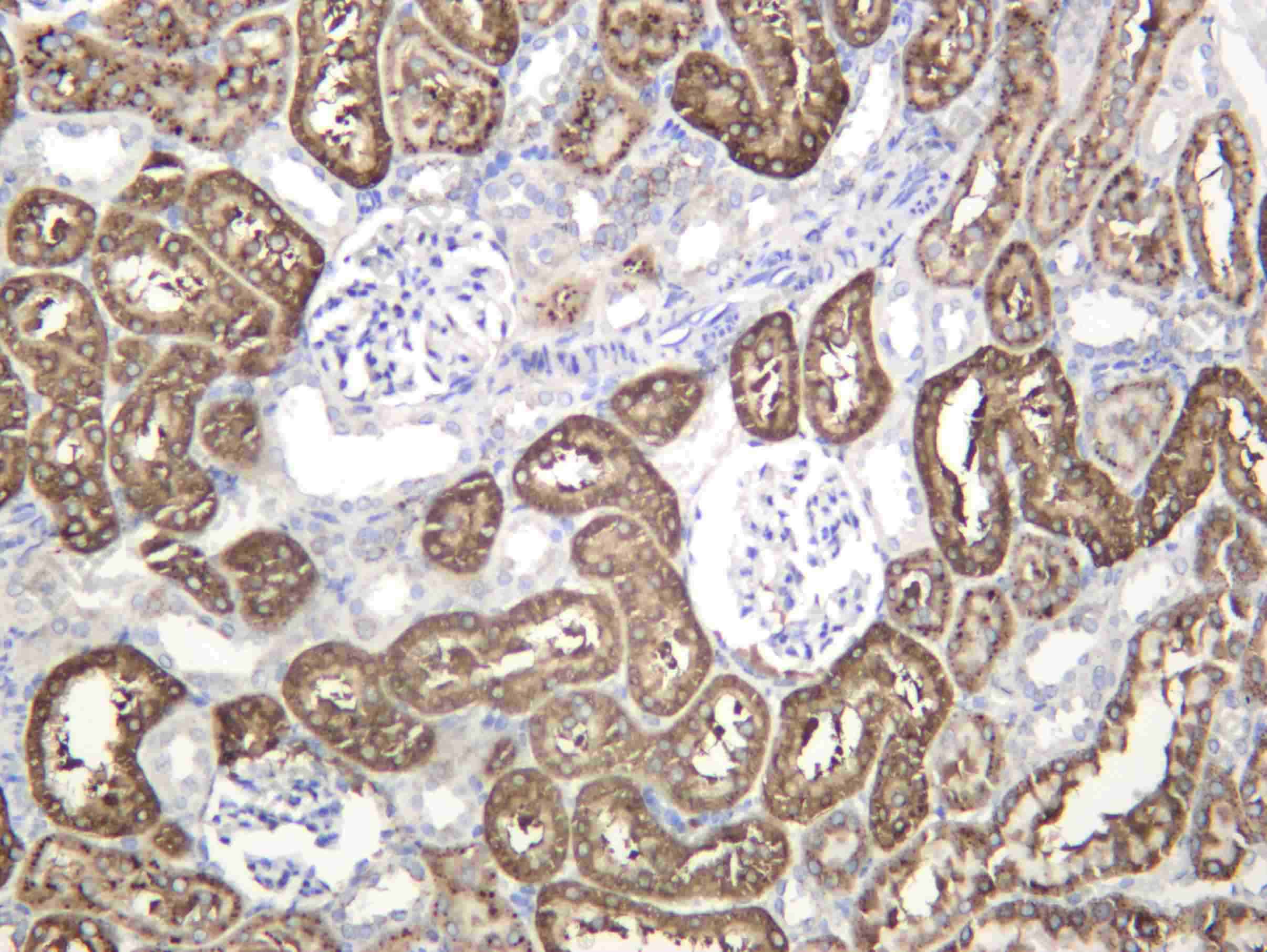 Recombinant LGMN Monoclonal Antibody - 4