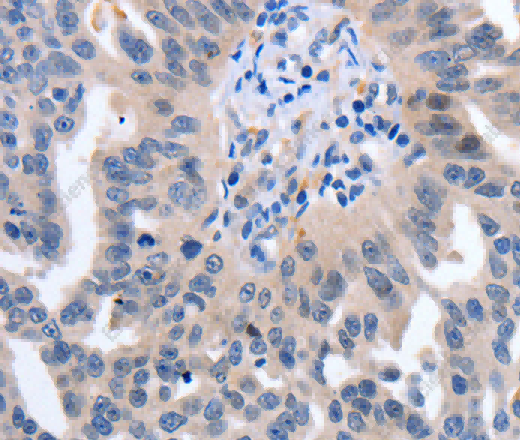 14-3-3 theta Polyclonal Antibody - 2