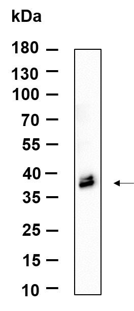 Recombinant ApoE Monoclonal Antibody-searchlist-1