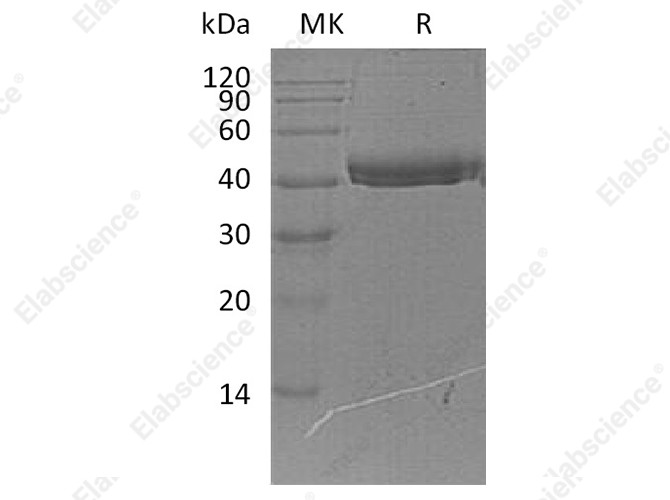 Recombinant Human COL9A1 Protein (His Tag) - 1