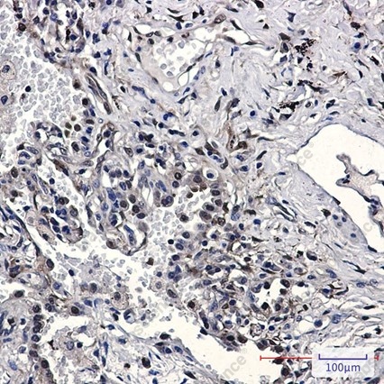 Recombinant Nampt Monoclonal Antibody - 6