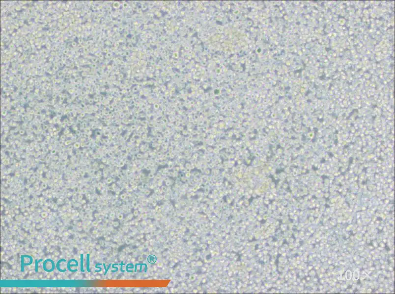H9 [derivative of HuT 78] Cell Complete Medium - 3
