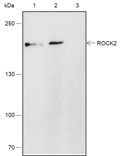 Recombinant ROCK2 Monoclonal Antibody - small - 5