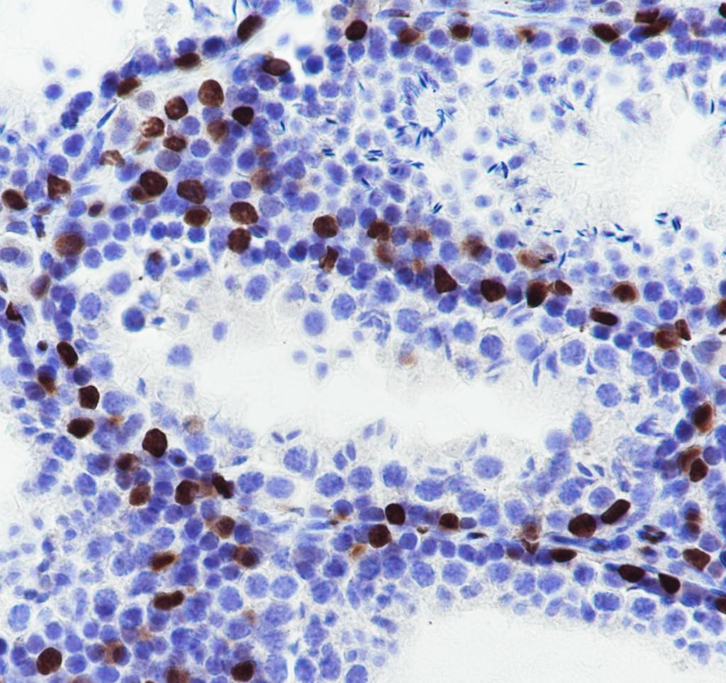 Recombinant WT1 Monoclonal Antibody - small - 6