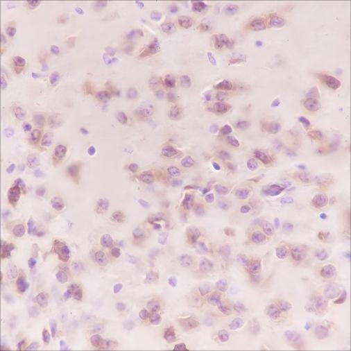 Recombinant Stathmin Monoclonal Antibody - small - 4